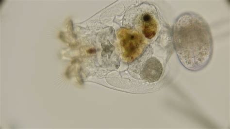 Brachionus Plicatilis Rotifer How It Feeds And How Microorganisms Get