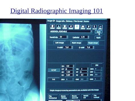 Ppt Digital Radiographic Imaging 101 Digital Radiography Dr Image