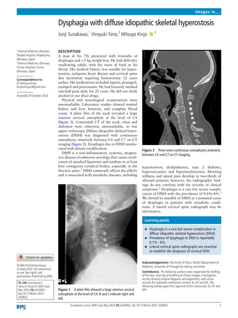 Dysphagia With Diffuse Idiopathic Skeletal Hyperostosis Bmj Case Reports