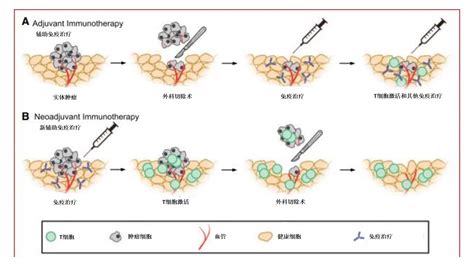 科学网—新辅助免疫治疗的发展 阎影的博文