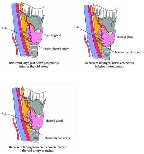 Trajectory Rln And Its Relationship With The Vascularization Of The