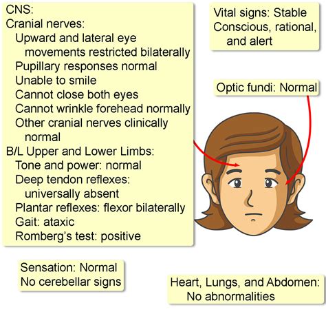 Miller Fisher Syndrome Pictures