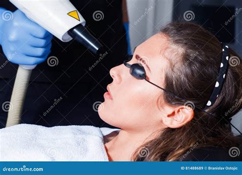 Tratamento Do Laser Da Cara Da Mulher Imagem De Stock Imagem De