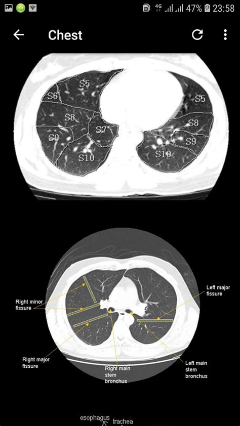 Atlas of CT Anatomy APK for Android Download