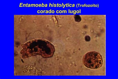 Parasitología Udocz