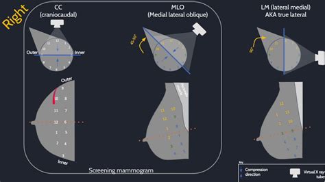 Approach To Breast Radiology Youtube