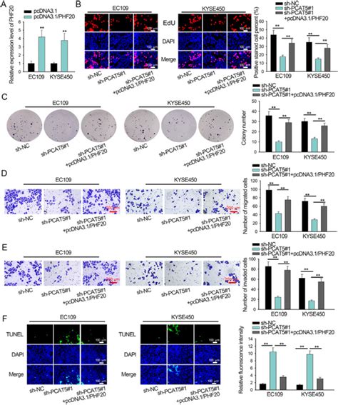 Long Non Coding Rna Pcat5 Regulates The Progression Of Esophageal