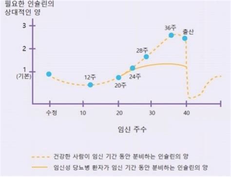 임신일기 31주차 임당 산모의 임신성 당뇨