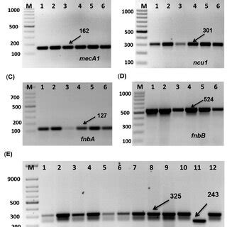 Amplification of Biofilm formation and MRSA genes of Staphylococcus ...