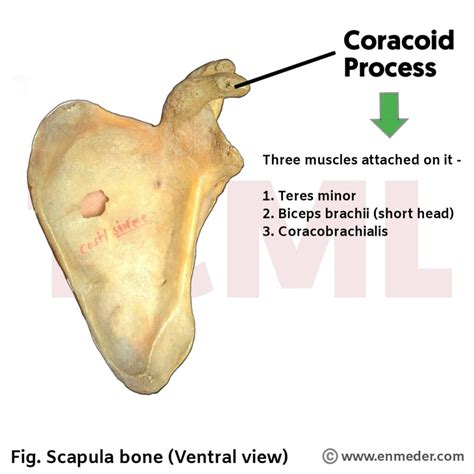 Coronoid Process