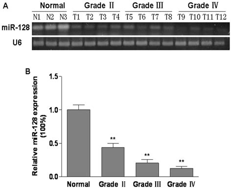 Mir Was Down Regulated In Human Glioma Tissues When Compared To