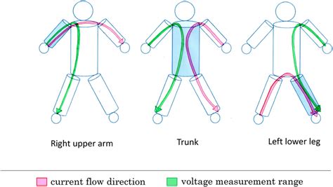 Direct Segmental Multi Frequency BIA Direct Segmental Multi Frequency