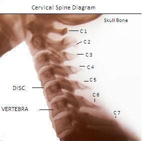 Cervical Spine Diagram, Picture of Spine, Expert Neurologist