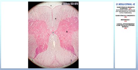 Histologia do Sistema Nervoso Histologia I Experimente a emoção das