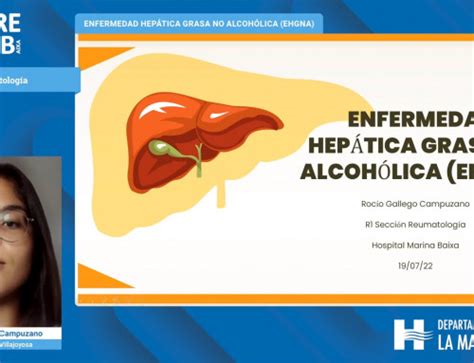 Enfermedad Pulmonar Intersticial En La Artritis Reumatoide Aire Mb