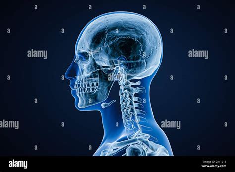 Xray Image Of Lateral Or Profile View Of Skull Of Adult Male With Body