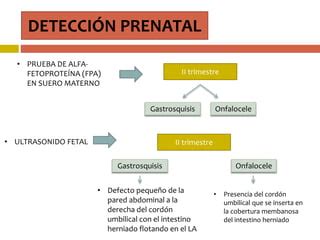 Gastrosquisis Y Onfalocele Ppt