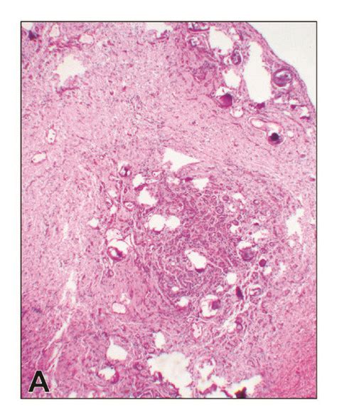 Photomicrographs Of The Permanent Section A 4x Objective At A Low