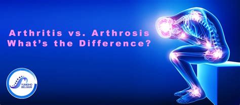 Arthritis Vs Arthrosis And What’s The Difference Yumeiho