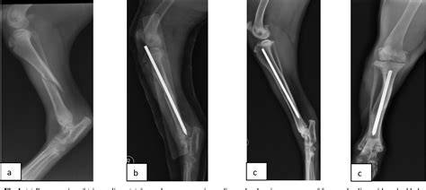 Figure 1 From Evaluation Of Intramedullary Pinning Technique For