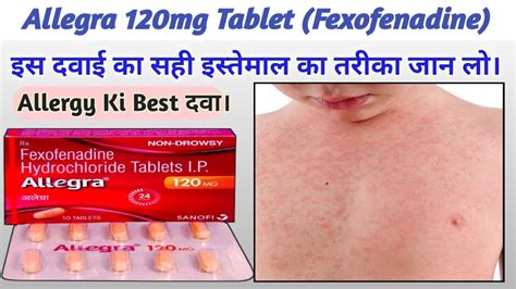 Fexofenadine Hydrochloride 120 mg Hindi | Allegra 120 mg uses in Hindi ...