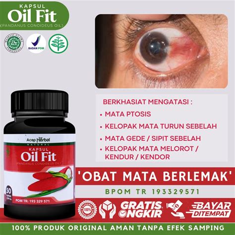 Jual Obat Mata Berlemak Penjernih Mata Merah Berlemak Mata Pterygium