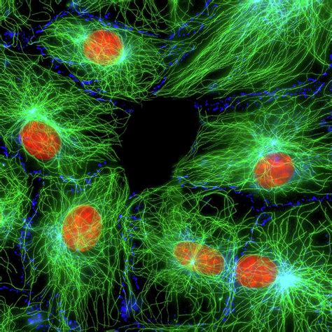 Fibroblast Cells Photograph By Dr Jan Schmoranzer Science Photo Library