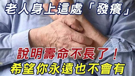 老人55歲後，若身上這處「發癢」，說明壽命已經不多了！一個不佔的人要恭喜了，活到100歲都沒問題三味書屋 Youtube