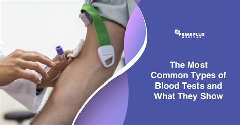 The Most Common Types of Blood Tests - Prime Plus Medical