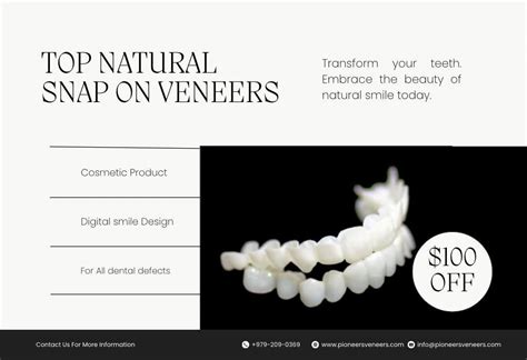 Snap On Veneers Are An Amazing Alternative To Teeth Whitening Or Porcelain Veneers.