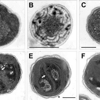 Transmission Electron Microscopy Of Synechocystis Cells Wt A