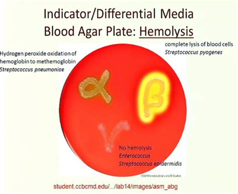 Blood Agar Flashcards | Quizlet