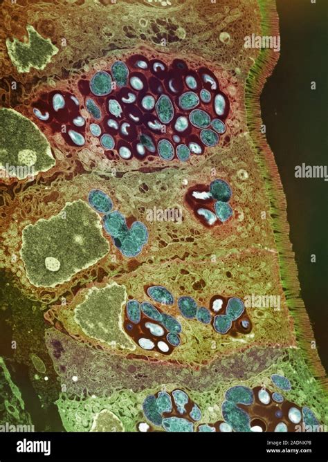 Protozoan Spore Formation Coloured Transmission Electron Micrograph