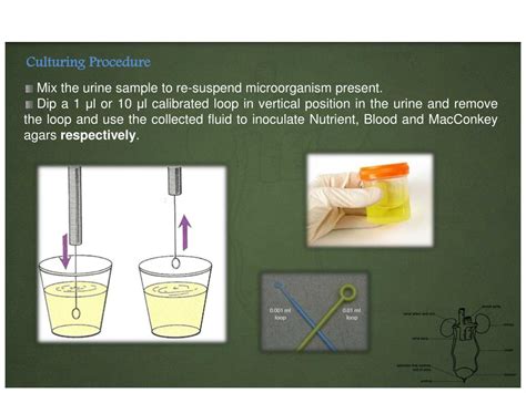 Ppt Urine Culture Powerpoint Presentation Id