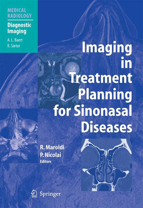 Clinical Anatomy Of The Nose Nasal Cavity And Paranasal Sinuses Ebook