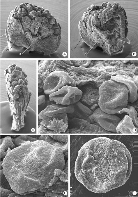 Pecinovia annonoides sp. et gen. nov., Pecínov unit 2, F 2630. A-C,... | Download Scientific Diagram