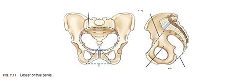 lesser or true pelvis Diagram | Quizlet