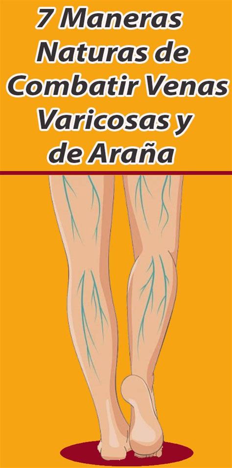 7 Maneras Naturas De Combatir Venas Varicosas Y De Araña Salud Y