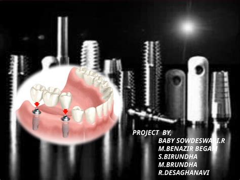 Pptx Types And Classification Of Dental Implants Dokumen Tips