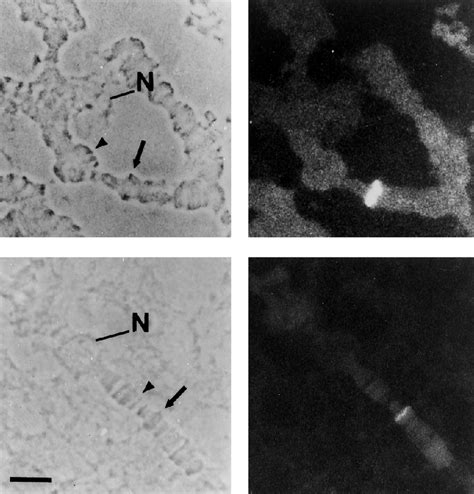 Hybridization In Situ Of A Digoxigenin Labeled Kb Pcr Probe From