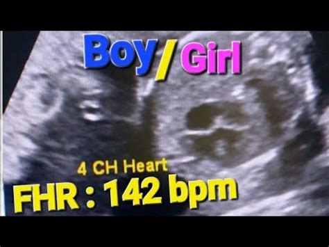 heartbeat ultrasound sound heart rate boygirl fetal doppler