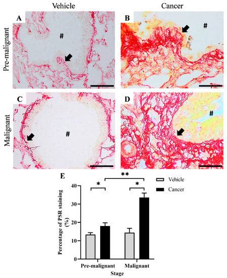 Biomedicines Free Full Text Tissue Rigidity Increased During