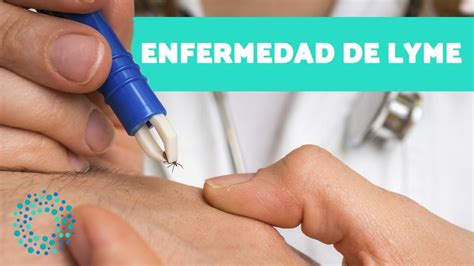 Qu Es La Enfermedad De Lyme Causas S Ntomas Y Tratamiento Youtube