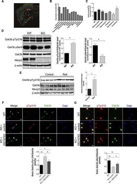 Inhibition Of Gsk3b Reduces Nfkb1 Signaling And Rescues Synaptic