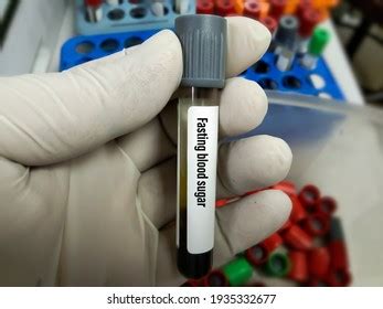 608 Fasting Blood Glucose Images Stock Photos Vectors Shutterstock