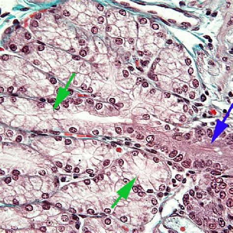 Branched Brunner S Glands Goldner S Trichrome Stain Blue Arrow