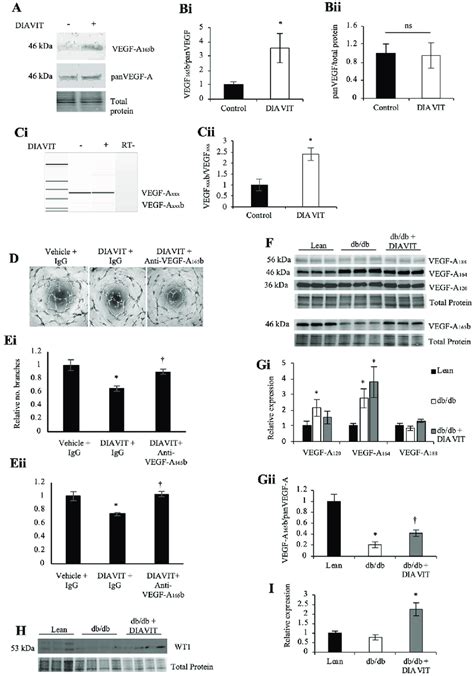 Diavit Alters Vegf A Splicing To Increase Vegf A 165 B A Diavit