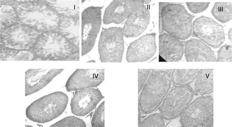 Photomicrographs Of The Testes Of I Control Rats Showing The Normal Download Scientific