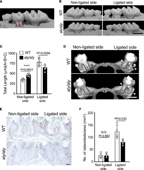 Alveolar Bone Resorption Was Inhibited In A Ligation Induced Download Scientific Diagram