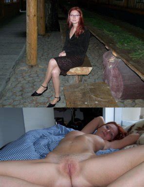 Leg Flesh Human Body Thigh Porn Pic